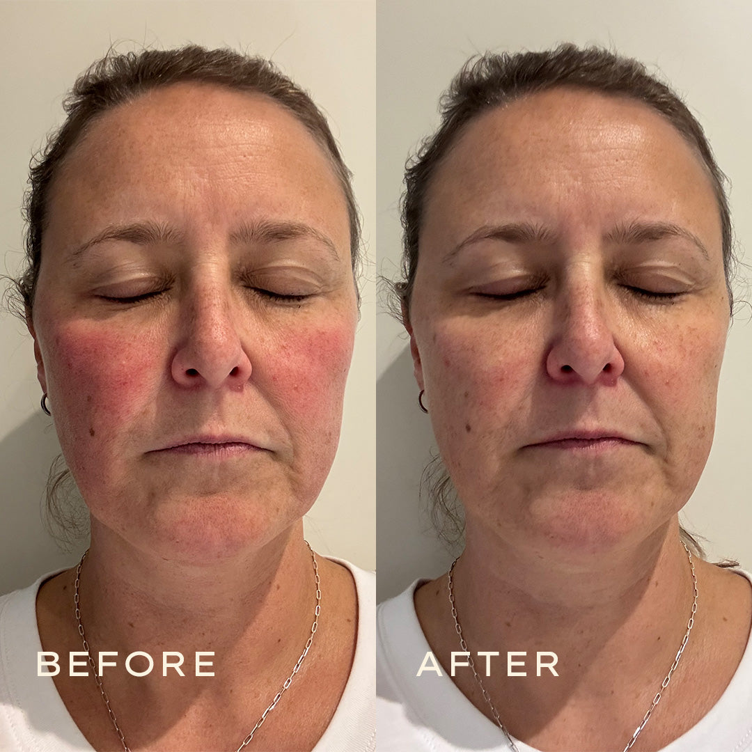 Calendula2025_11_Before  After 1080x1080 Serum 2jpg