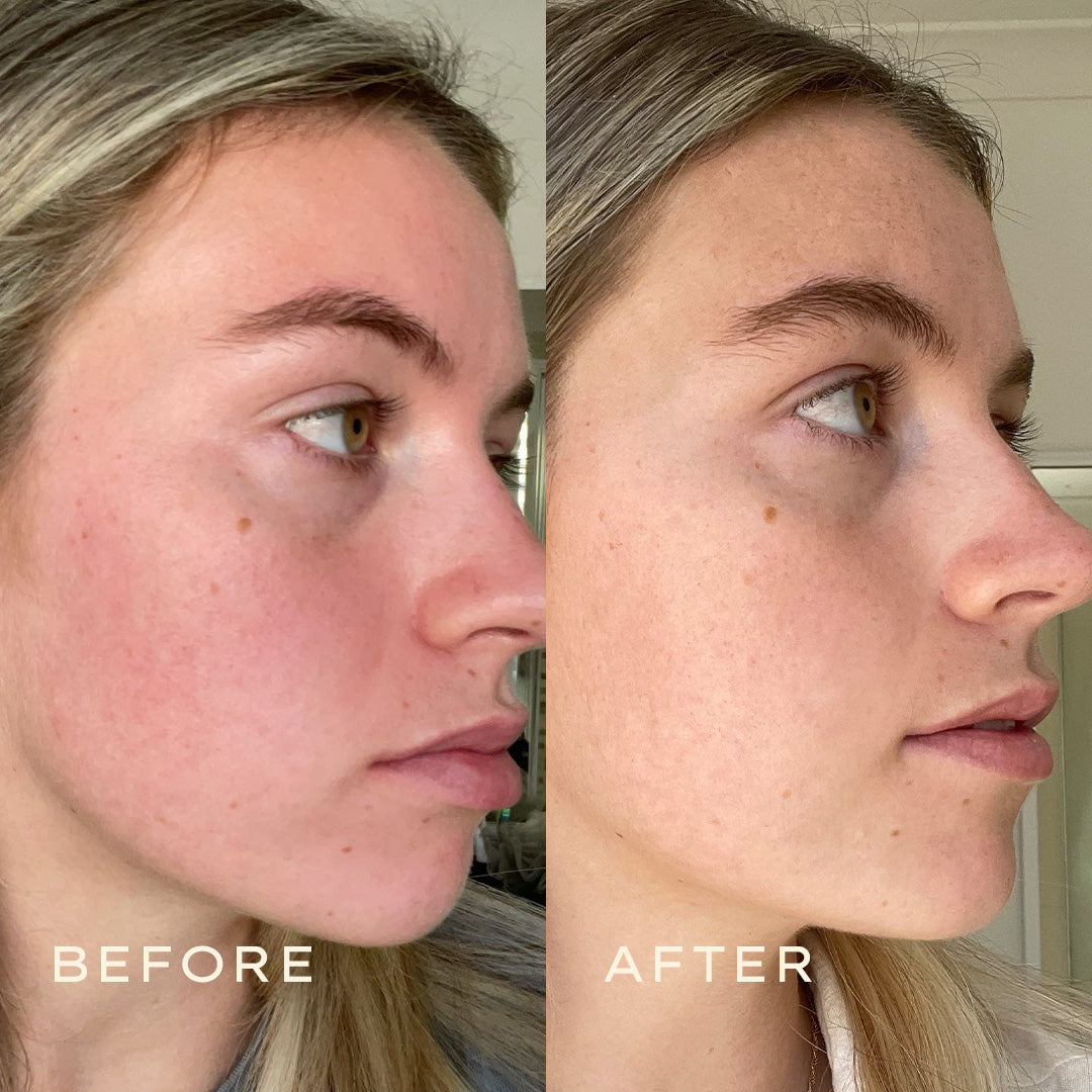 Calendula2025_11_Before  After 1080x1080 Tonerjpg